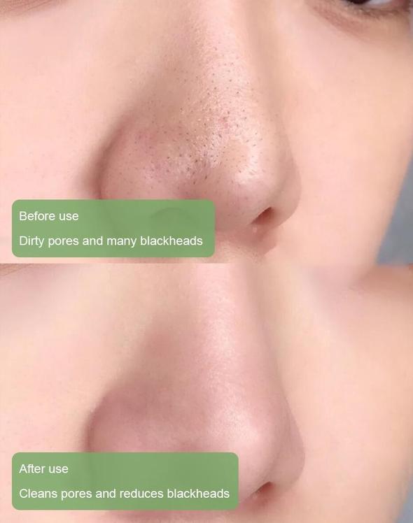 Hot Sale--Poreless Deep Cleanse Mask Stick